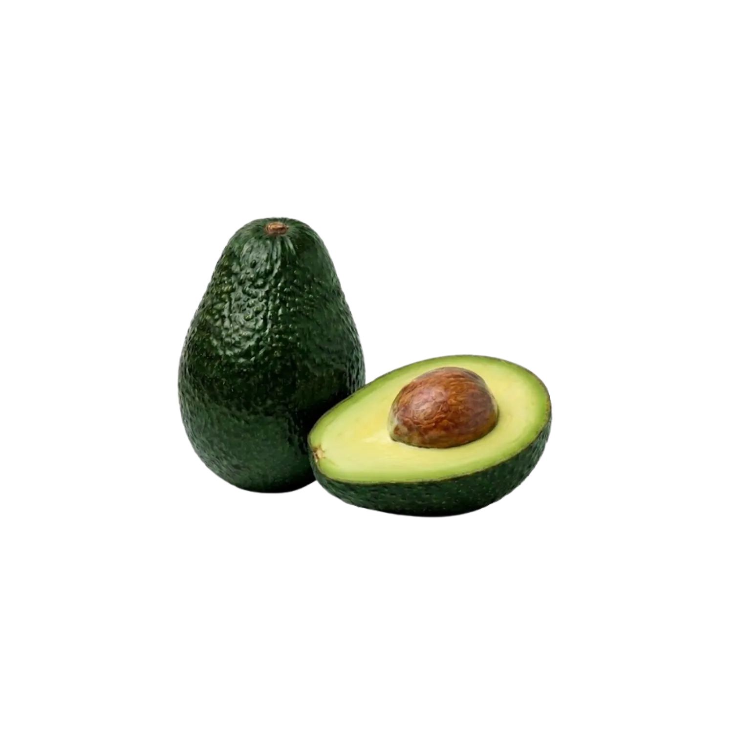 Avocat